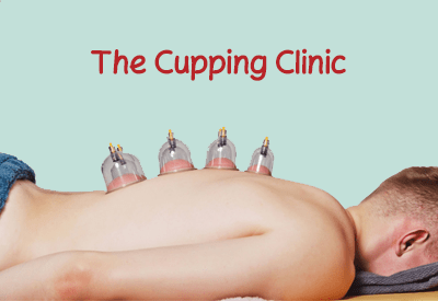 The cupping clinic