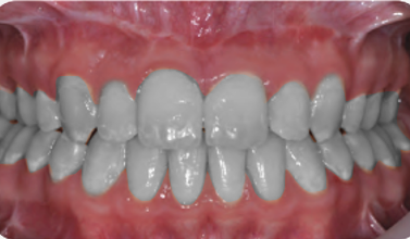 Surgical orthodontic cases B