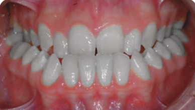 Surgical orthodontic cases B